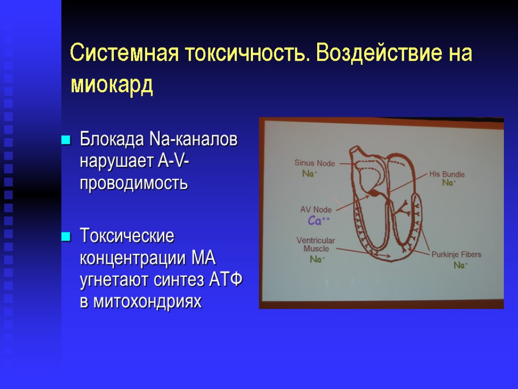 Системная токсичность. Воздействие на миокард Блокада Na-каналов нарушает A-V-проводимость Токсические концентрации МА угнетают синтез